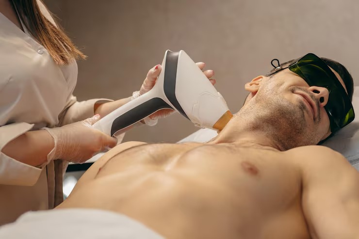 full body laser hair removal